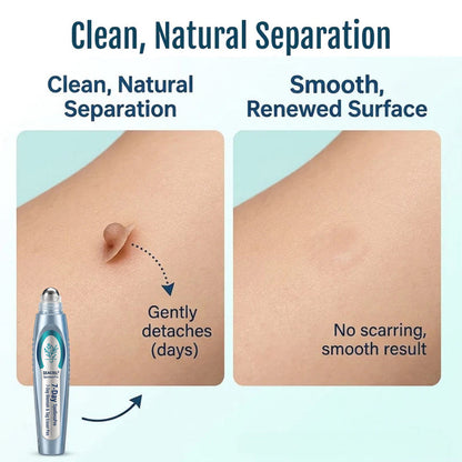 SEAGRIL® SpotlessPro Advanced Skin Care Pen