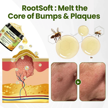✅SEAGRIL® BeePeptide RootSoft DualRelief Cream⚕️ ( Buy 1 Get 1 Free)