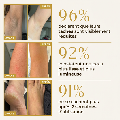 Spray Exfoliant Anti-Taches Corps · Kojic Acid 99%